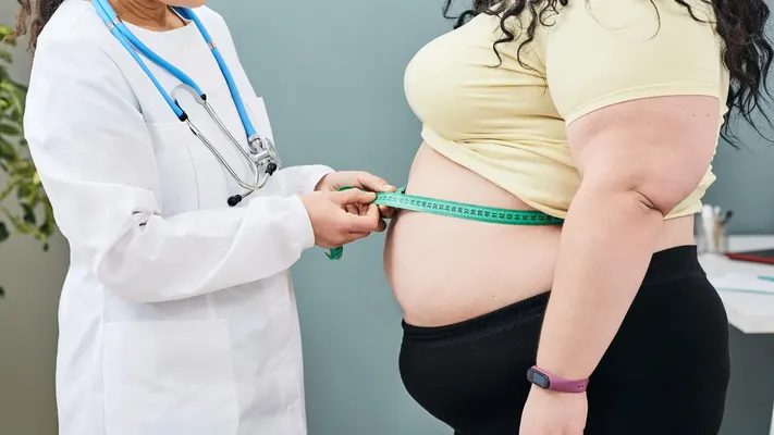 doctor measuring belly size to estimate obesity