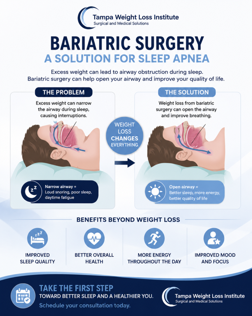 infographic showing how bariatric surgery is a solution to sleep apnea
