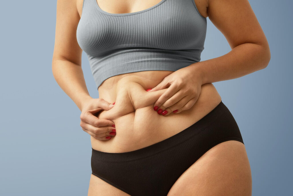belly fat