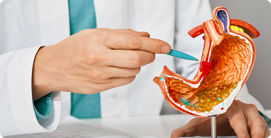 duodenal switch and pregnancy