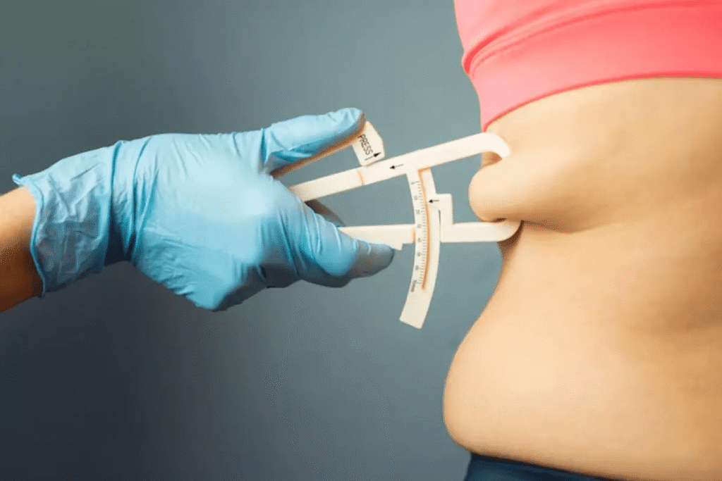 duodenal switch weight loss